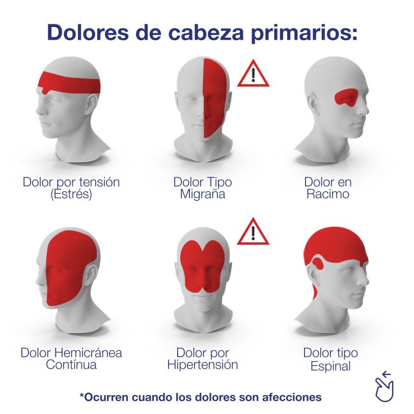 tipos de dolores de cabeza.