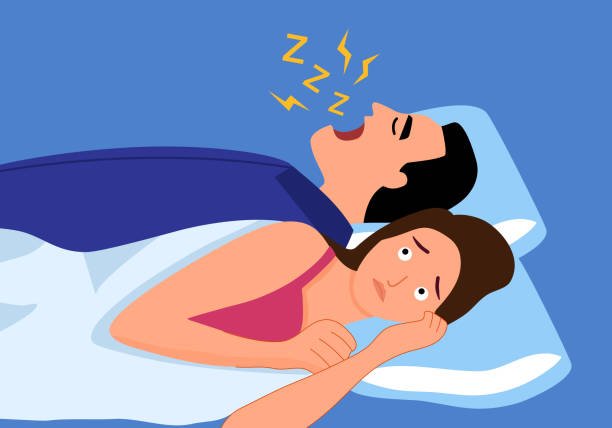 Ilustración médica que muestra el bloqueo de las vías respiratorias superiores durante un episodio de apnea obstructiva del sueño